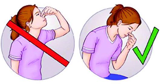 如何预防鼻中隔偏曲